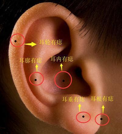 左耳長痣|耳朵痣位置：影響健康？